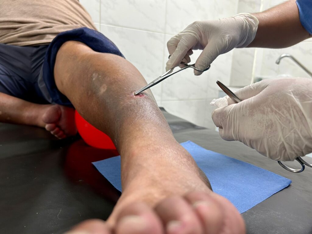 Ecatepec rescata clínica especializada en pie diabético; 90 por ciento de pacientes logra sanar